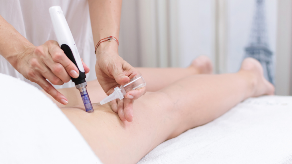 Imagen tratamiento dermapen
