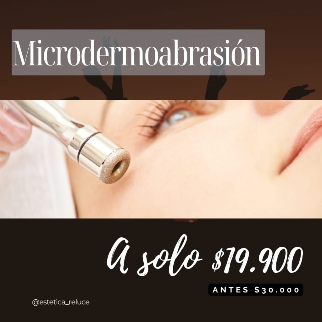 sesión de microdermoabrasión facial por solo $19.900